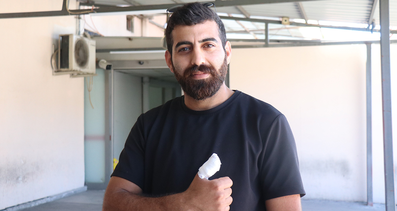 "Amca beni yaktın"