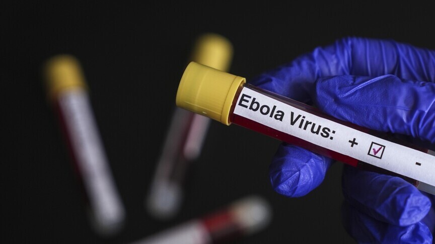 DSÖ, Ebola salgınının görüldüğü KDC ve Uganda'ya seyahat ve ticaret kısıtlaması önermiyor